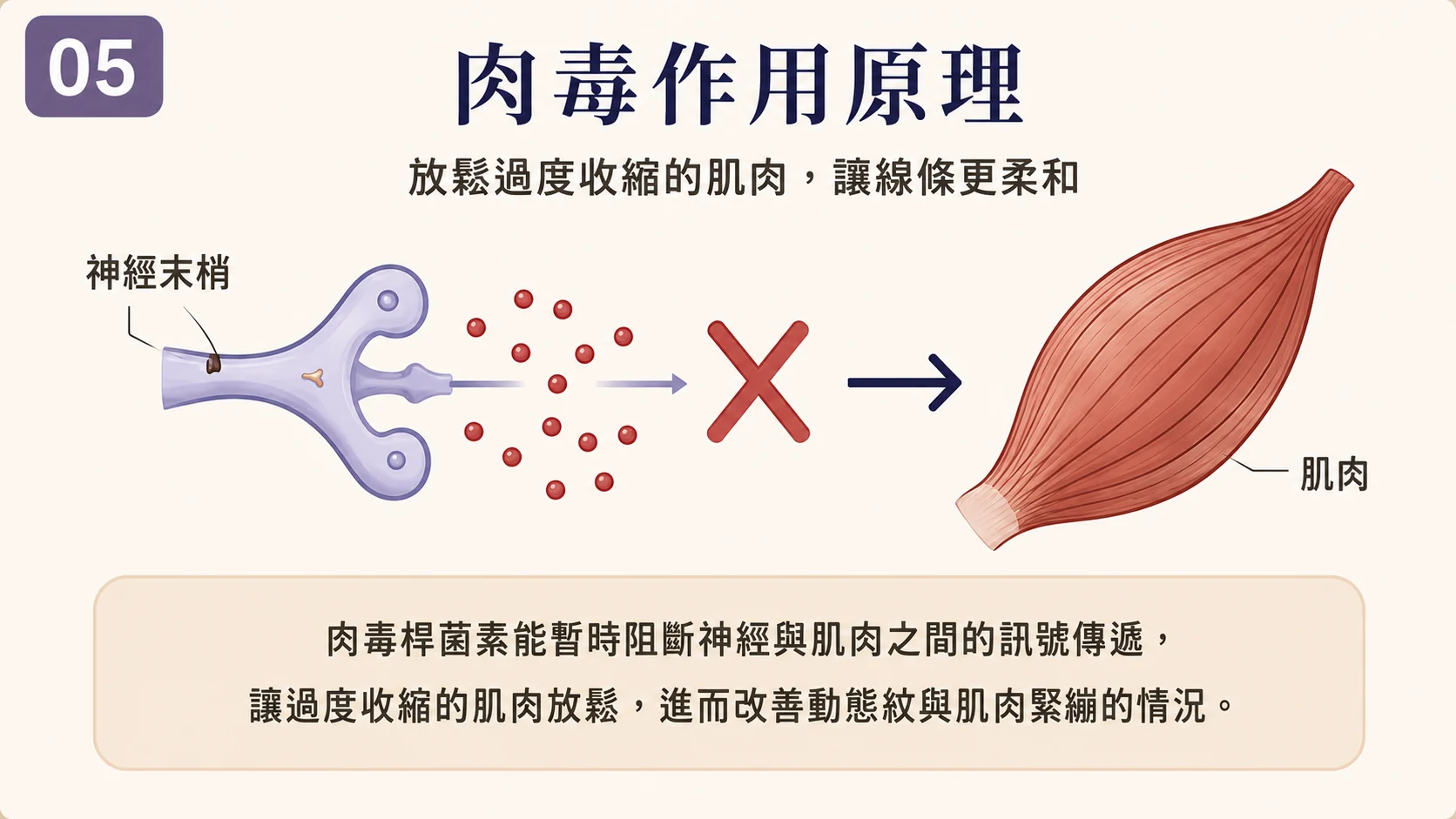 肉毒桿菌毒素作用的一般示意