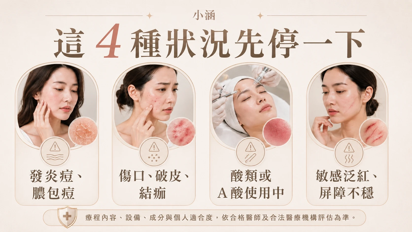 暫緩評估：這 4 種狀況先讓皮膚穩定